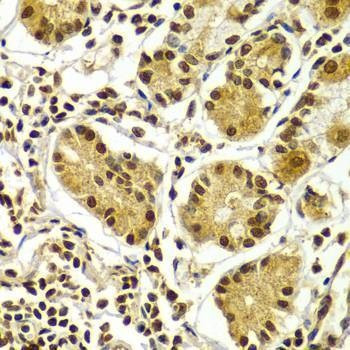 Anti-APTX Antibody