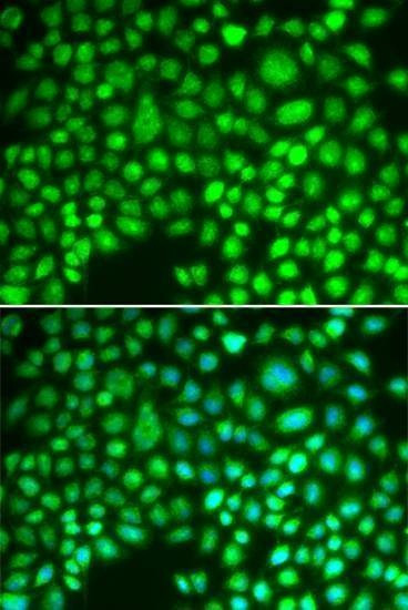 Anti-APTX Antibody