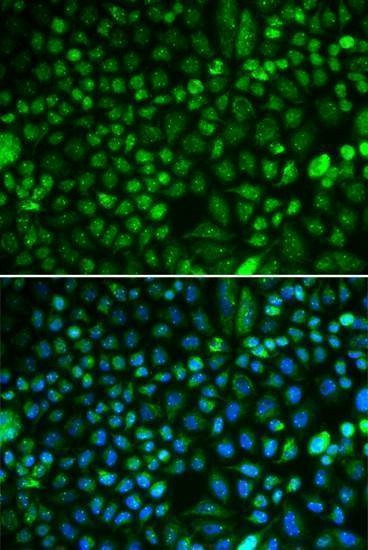 Anti-PA2G4 Antibody