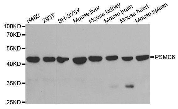Anti-PSMC6 Antibody