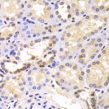 Anti-PSMC6 Antibody