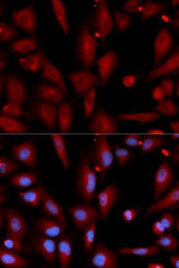 Anti-WIF1 Antibody