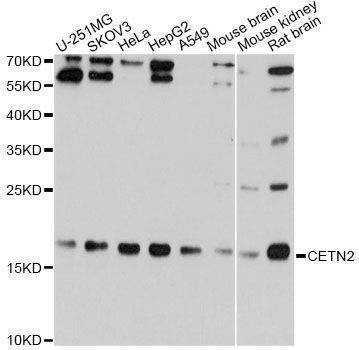 Anti-CETN2 Antibody