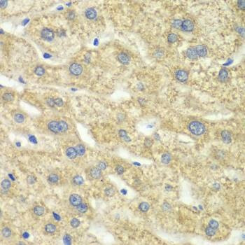 Anti-DLD Antibody
