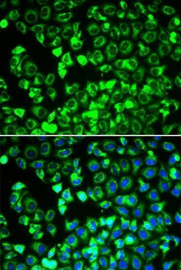 Anti-DLD Antibody