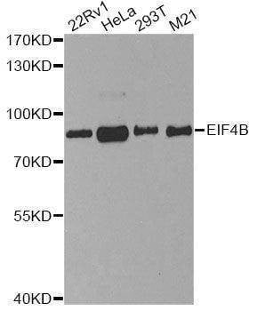 Anti-EIF4B Antibody