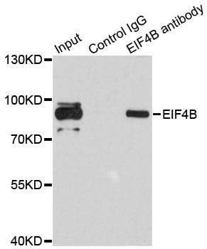 Anti-EIF4B Antibody