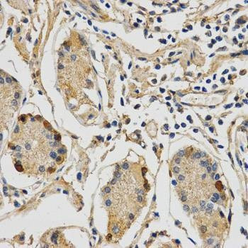 Anti-STXBP1 Antibody