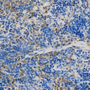 Anti-STXBP1 Antibody