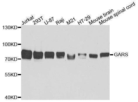 Anti-GARS Antibody