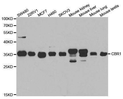Anti-CBR1 Antibody