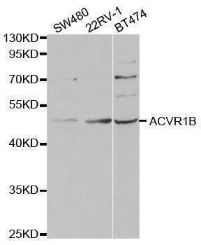 Anti-ACVR1B Antibody