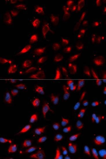 Anti-CPE Antibody