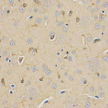 Anti-CPE Antibody