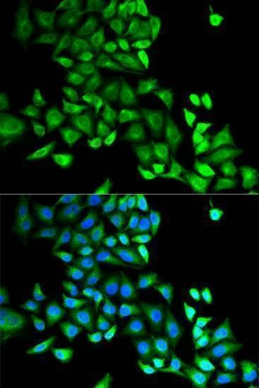 Anti-GDI1 Antibody