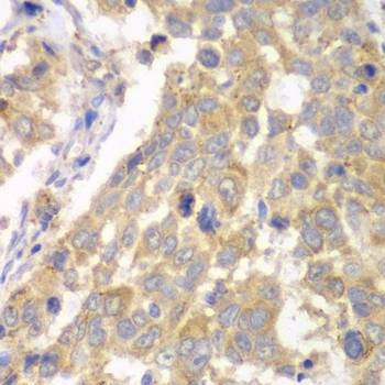 Anti-PFKM Antibody
