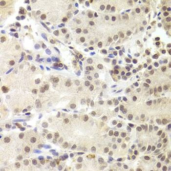 Anti-PRPF3 Antibody