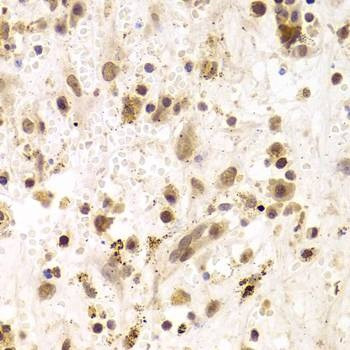Anti-PRPF3 Antibody