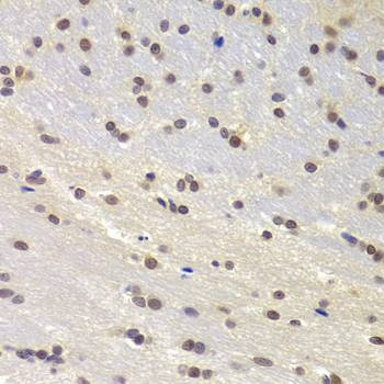 Anti-PRPF3 Antibody