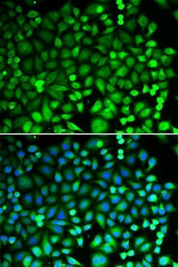 Anti-PSMB2 Antibody