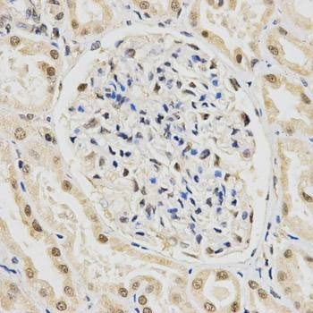 Anti-SNRPE Antibody
