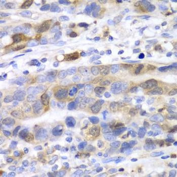 Anti-UBE2C Antibody