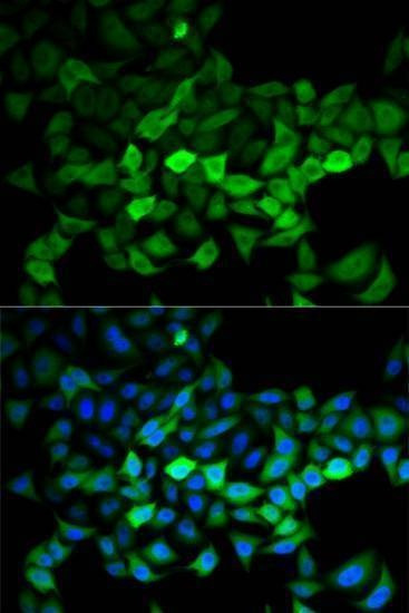 Anti-UBE2C Antibody