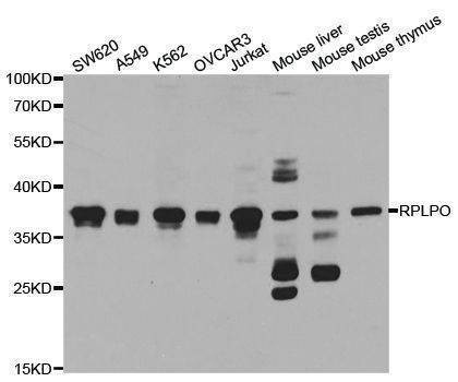 Anti-RPLP0 Antibody
