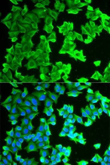 Anti-RPLP0 Antibody