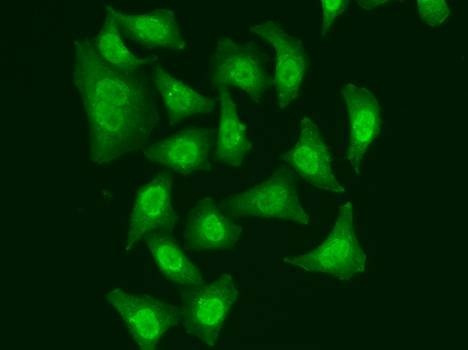 Anti-CDC5L Antibody
