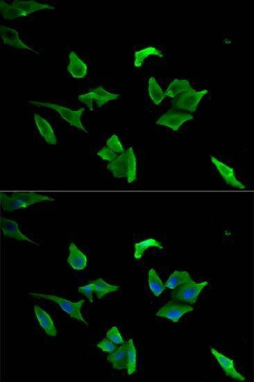 Anti-LCP1 Antibody