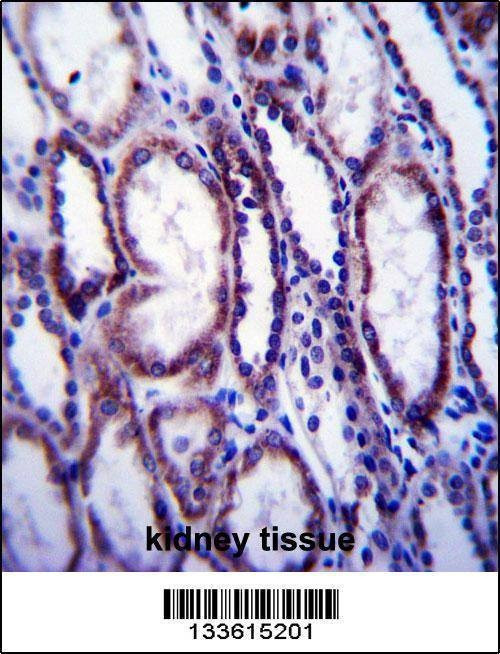 Anti-COL1A1 (C-term) Antibody