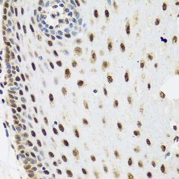 Anti-SKIV2L2 Antibody