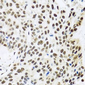 Anti-FUBP1 Antibody
