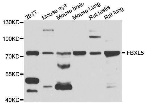 Anti-FBXL5 Antibody