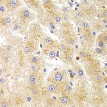 Anti-TK1 Antibody