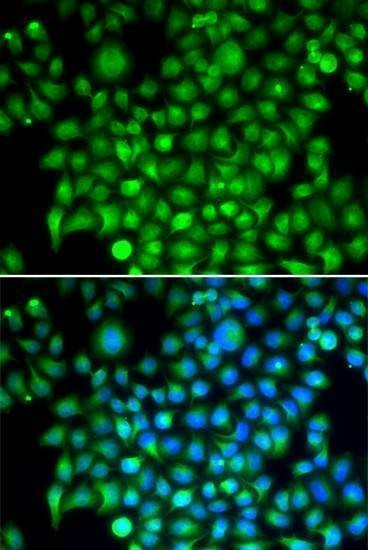 Anti-CFI Antibody