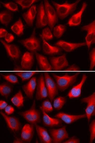 Anti-DDX3X Antibody