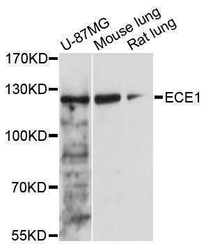 Anti-ECE1 Antibody