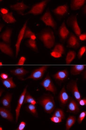 Anti-FLI1 Antibody