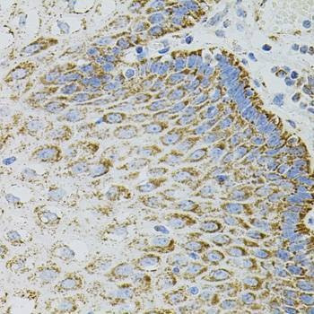 Anti-EPO Antibody