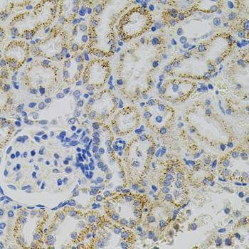 Anti-EPO Antibody