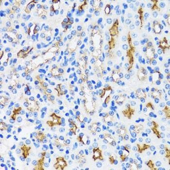 Anti-MME Antibody
