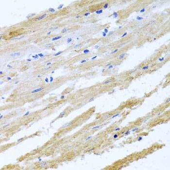 Anti-BNIP3 Antibody