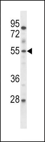 Anti-Mouse ETV6 (Center) Antibody