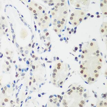 Anti-MECP2 Antibody