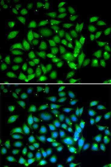 Anti-MECP2 Antibody