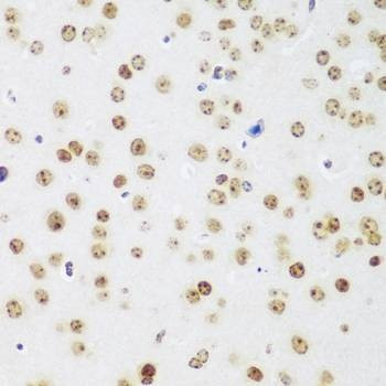 Anti-MECP2 Antibody