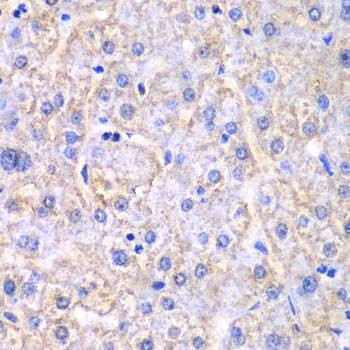 Anti-EHHADH Antibody