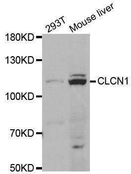 Anti-CLCN1 Antibody